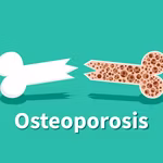 Osteoporosis - Fact File by QNET