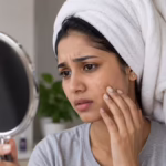 can hard water cause hair loss